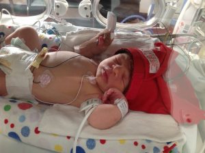 Image of an infant in a hospital crib. She in unwell with tubes and machines to help.
